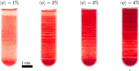 Abbildung von vier Blutproben mit unterschiedlicher Volumenkonzentration