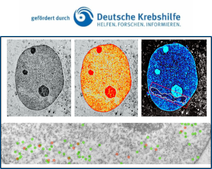 Strahleninduzierte DNA-Schäden im Kontext des Chromatins